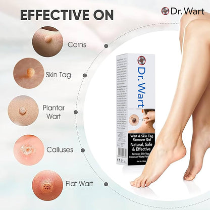 Wart Remover Gel